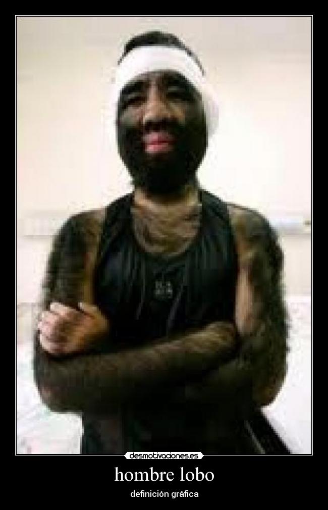 hombre lobo -