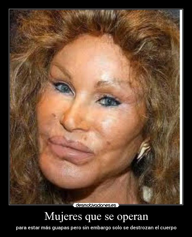 Mujeres que se operan - para estar más guapas pero sin embargo solo se destrozan el cuerpo