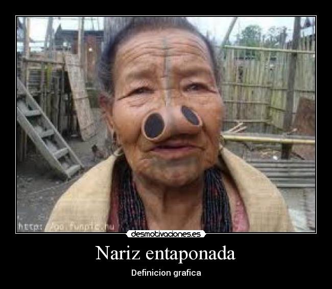 Nariz entaponada - Definicion grafica