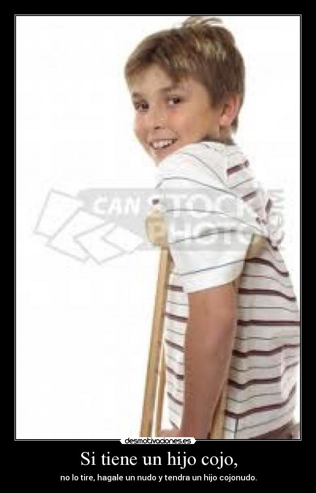 Si tiene un hijo cojo, -