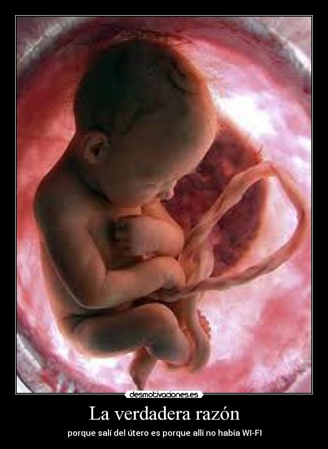 La verdadera razón -