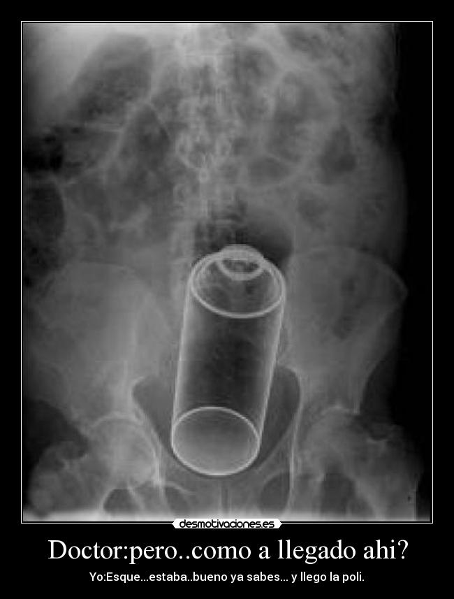 Doctor:pero..como a llegado ahi? -