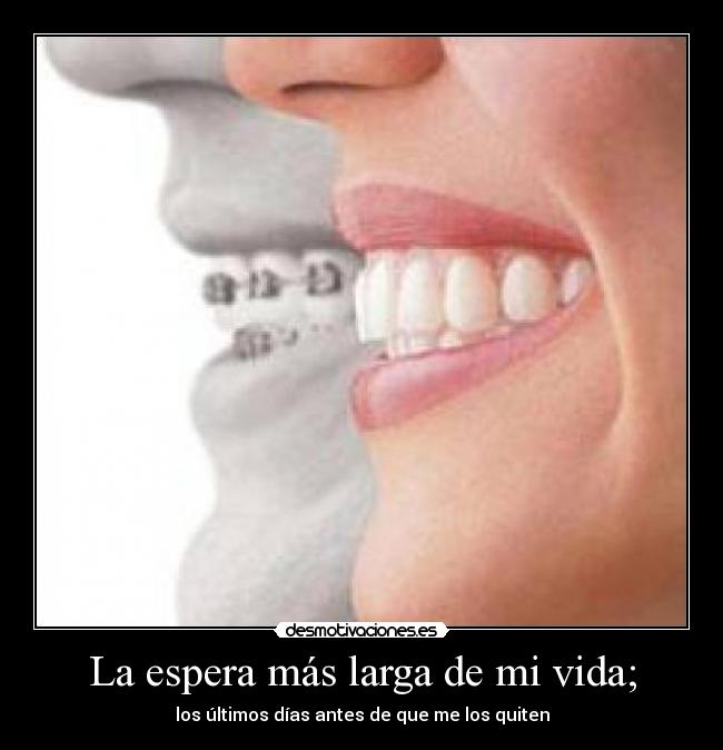 La espera más larga de mi vida; -