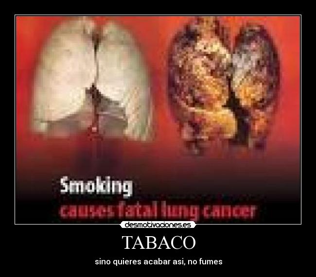 TABACO -