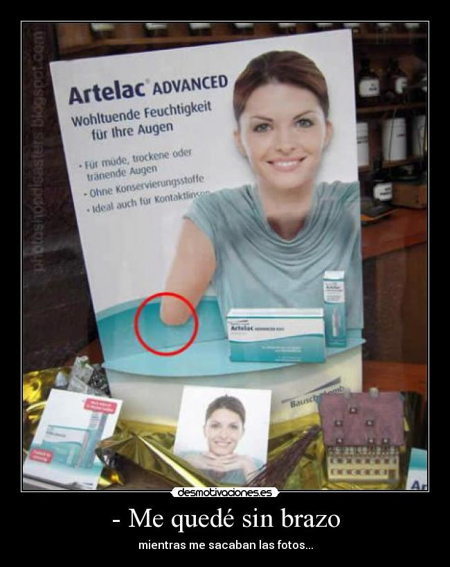- Me quedé sin brazo -