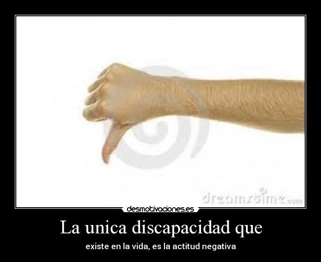 La unica discapacidad que -