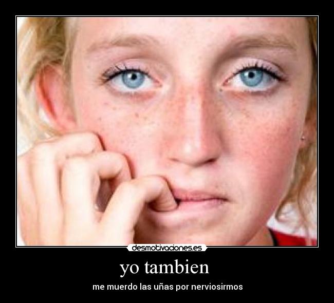 yo tambien  - 