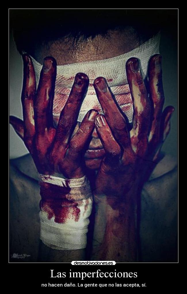 Las imperfecciones -