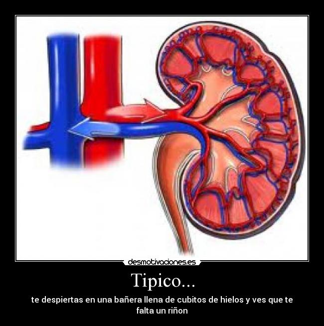 Tipico... - te despiertas en una bañera llena de cubitos de hielos y ves que te falta un riñon