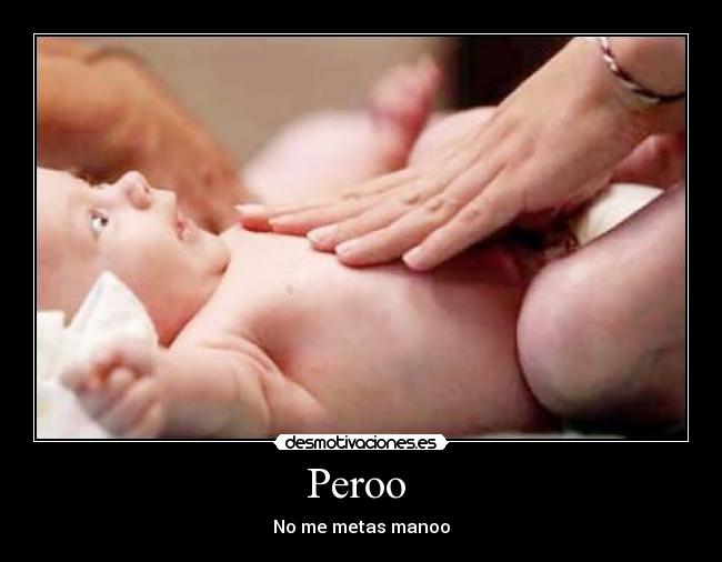 Peroo -