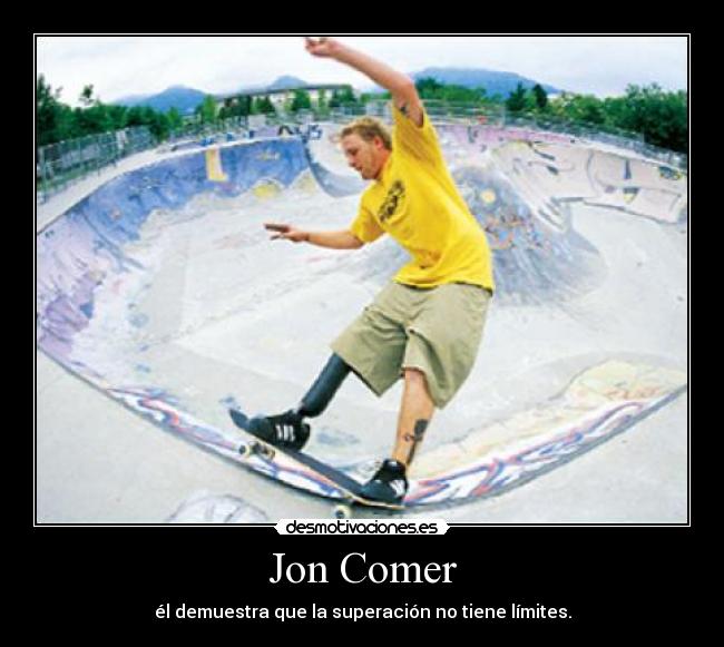 Jon Comer - él demuestra que la superación no tiene límites.