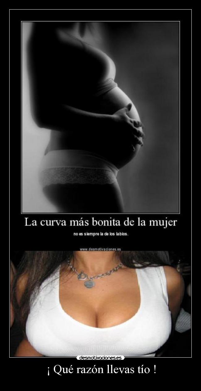 ¡ Qué razón llevas tío ! - 