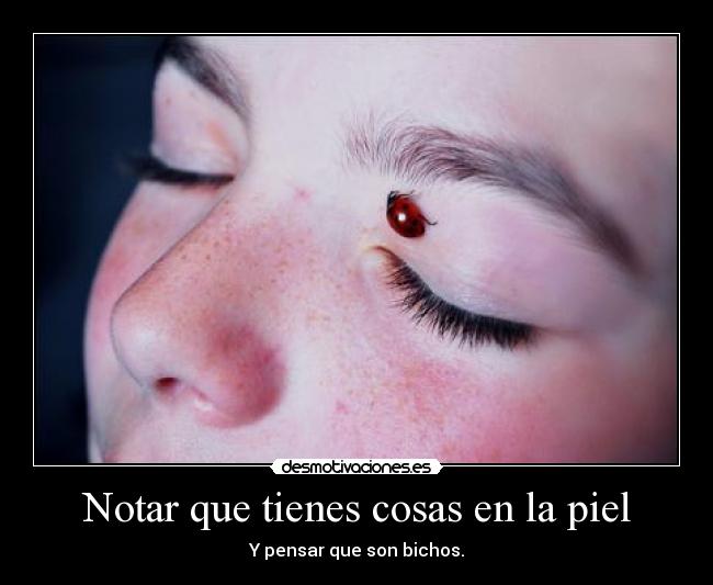 Notar que tienes cosas en la piel - 