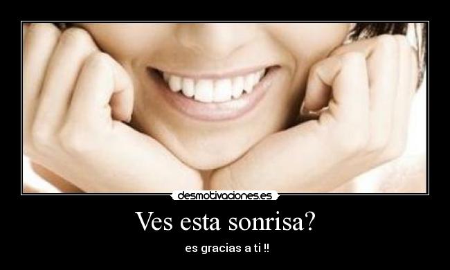 Ves esta sonrisa? -  es gracias a ti !!