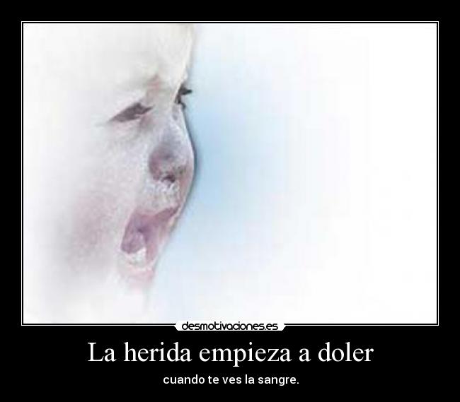 La herida empieza a doler -