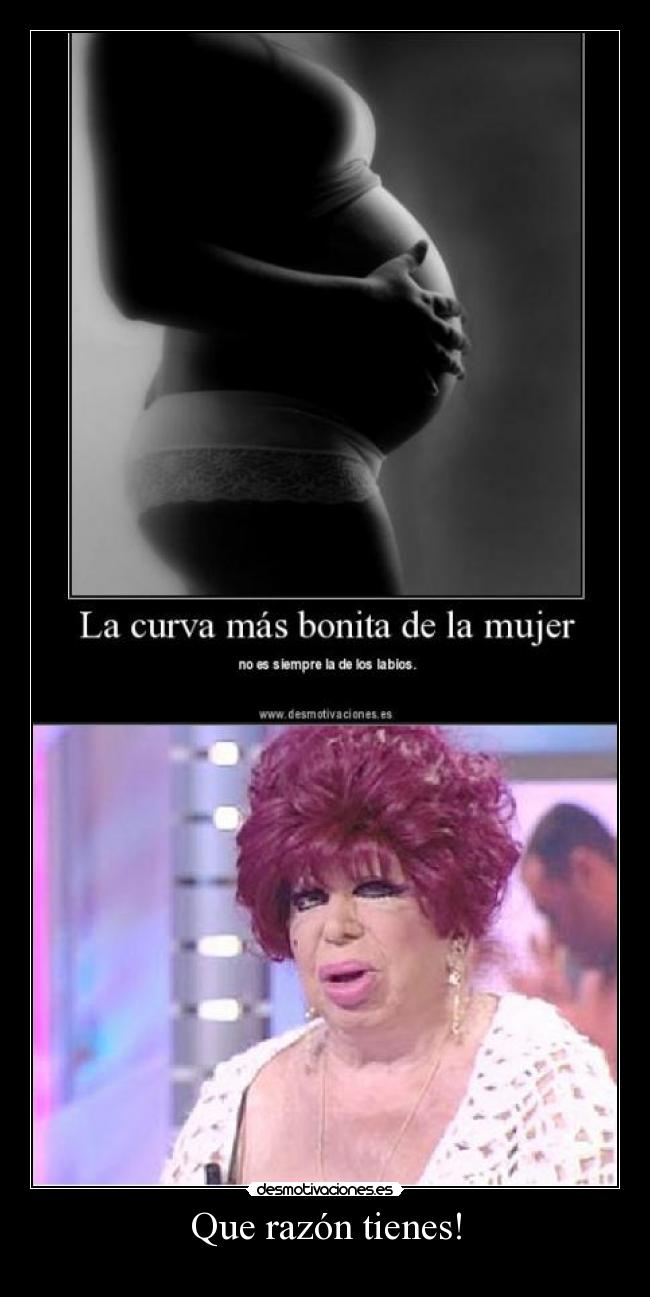 Que razón tienes! - 