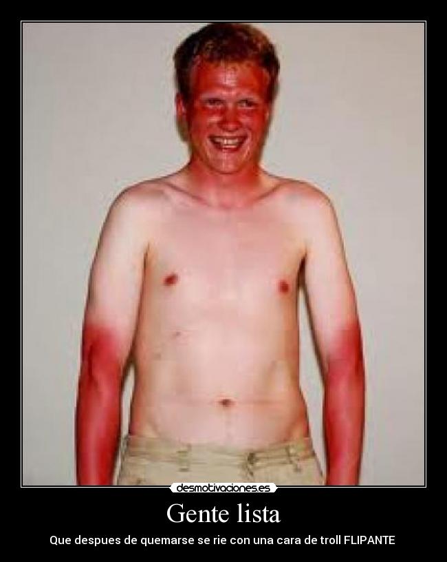 Gente lista - Que despues de quemarse se rie con una cara de troll FLIPANTE 