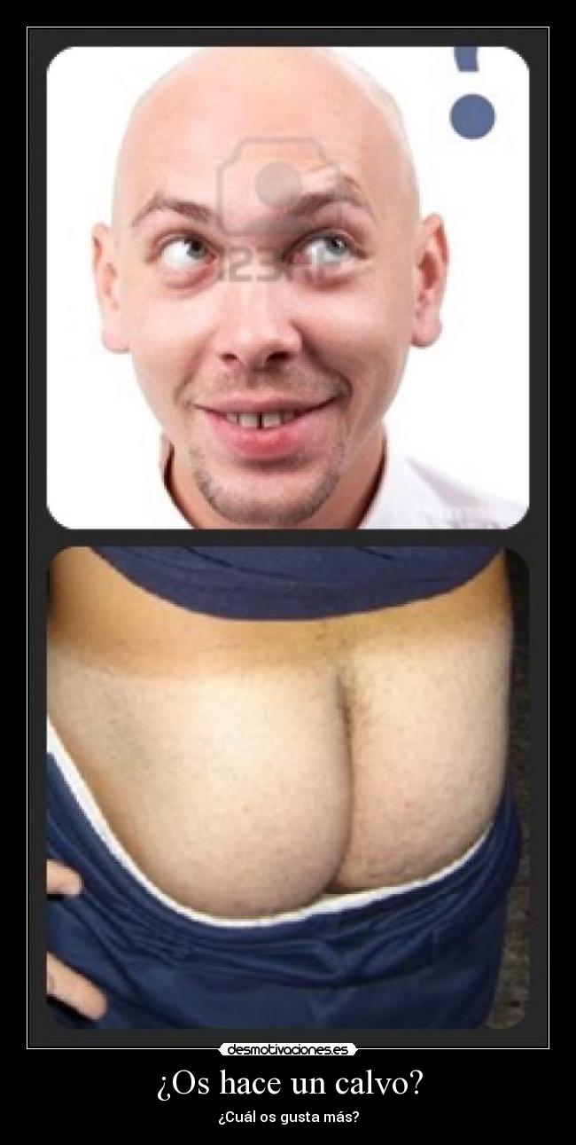 ¿Os hace un calvo? - ¿Cuál os gusta más?