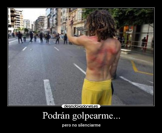 Podrán golpearme... - 