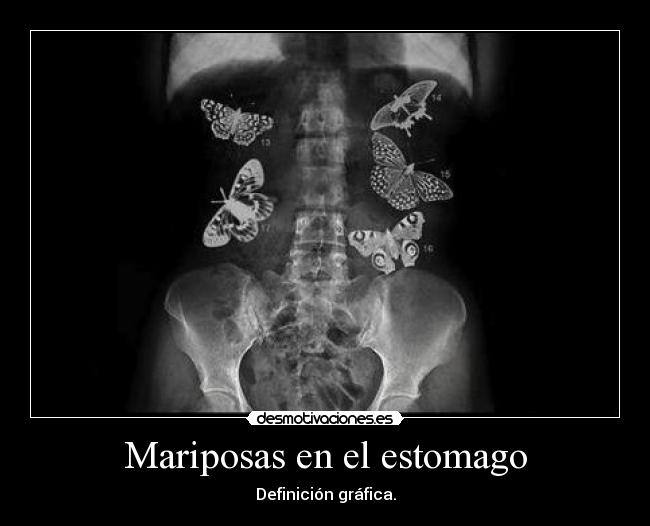 Mariposas en el estomago -