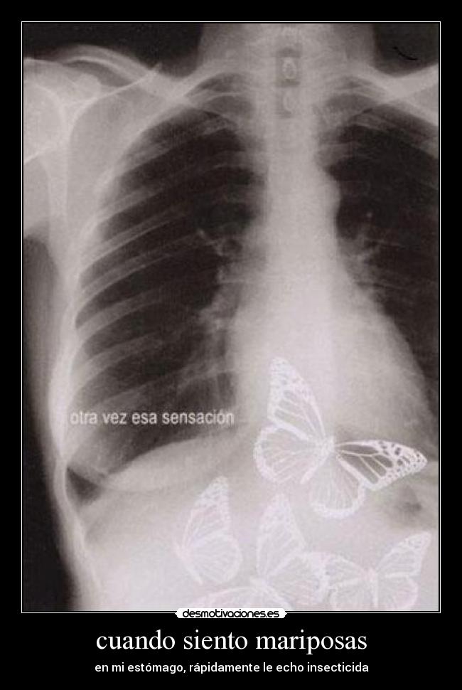 cuando siento mariposas - 