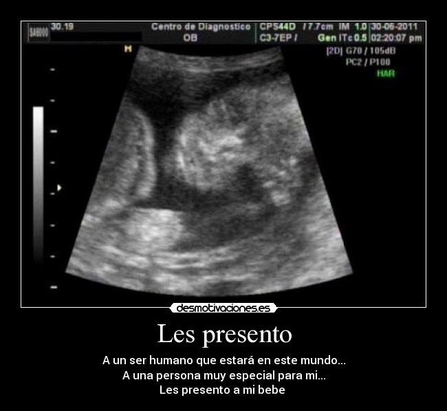 Les presento - 