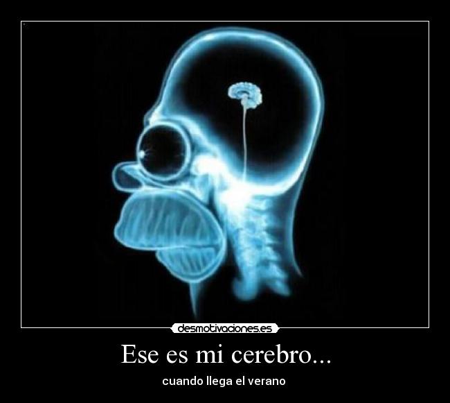 Ese es mi cerebro... - 