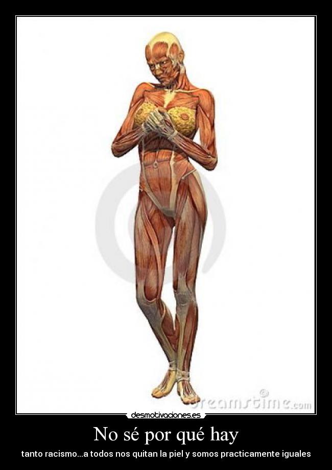 No sé por qué hay - 