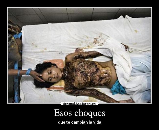 Esos choques -