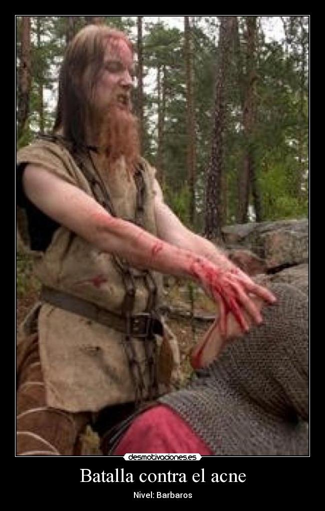 Batalla contra el acne -