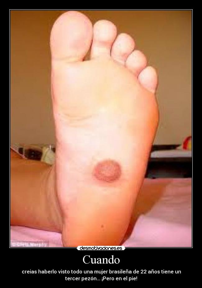 Cuando - creias haberlo visto todo una mujer brasileña de 22 años tiene un
tercer pezón... ¡Pero en el pie!