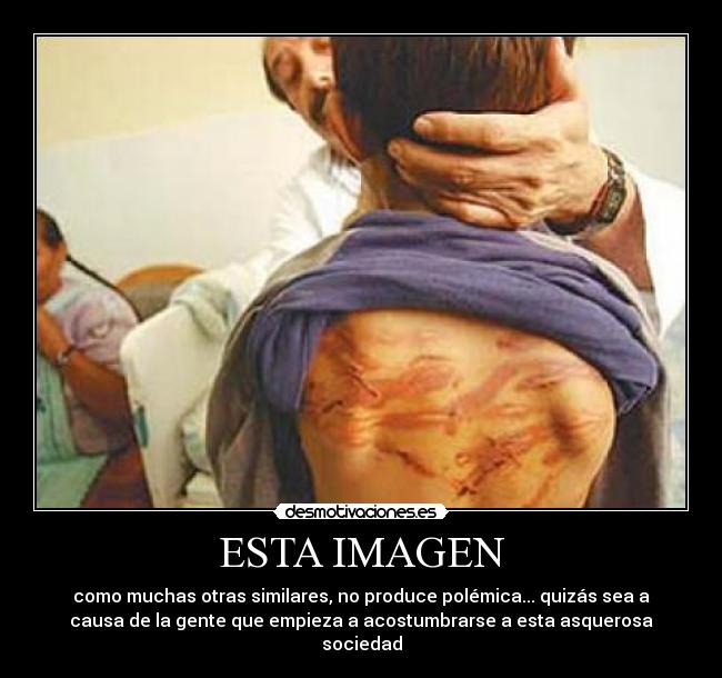 ESTA IMAGEN - 