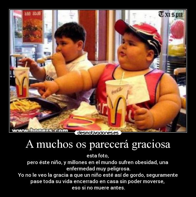 A muchos os parecerá graciosa - esta foto,
pero éste niño, y millones en el mundo sufren obesidad, una
enfermedad muy peligrosa.
Yo no le veo la gracia a que un niño esté así de gordo, seguramente
pase toda su vida encerrado en casa sin poder moverse,
eso si no muere antes.
