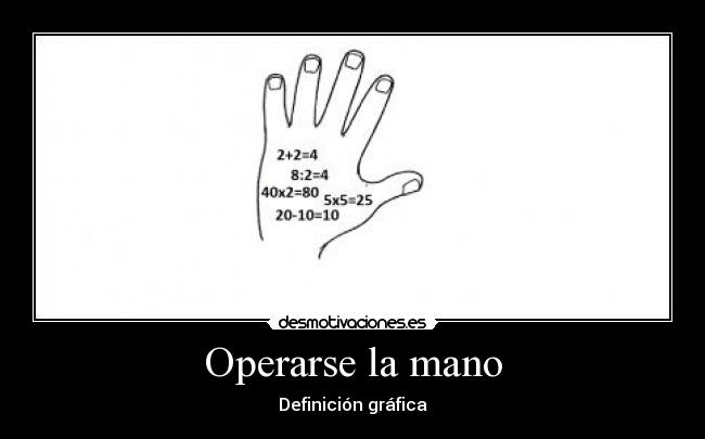 carteles operarse mano desmotivaciones