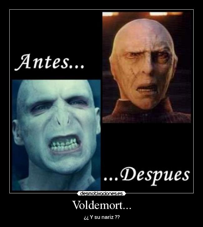 Voldemort... - ¿¿ Y su nariz ??