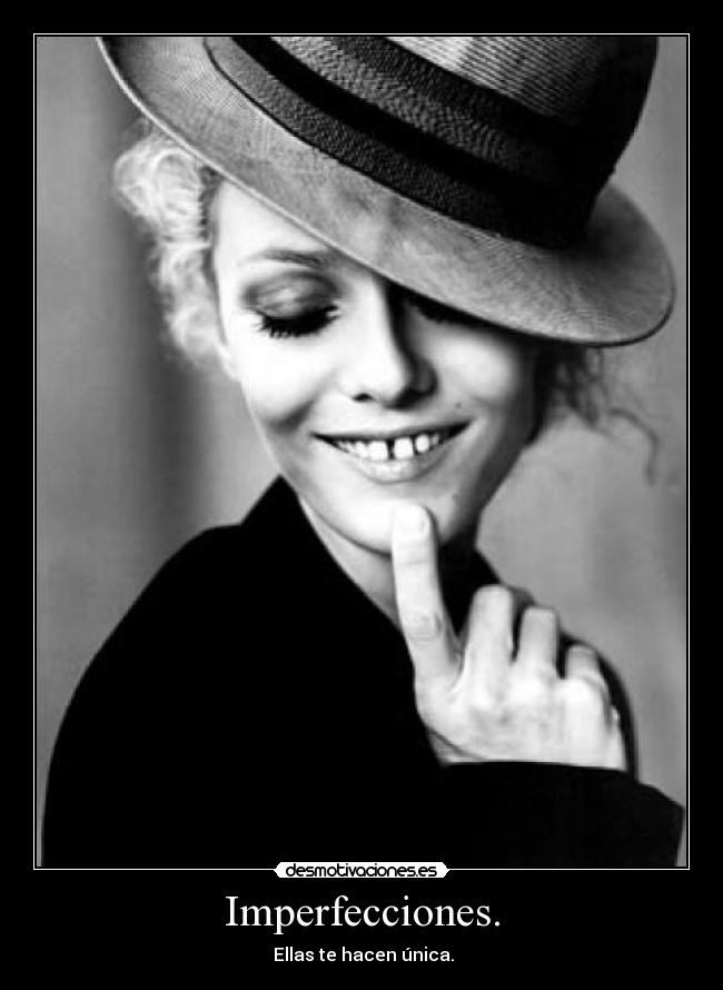 Imperfecciones. - Ellas te hacen única.