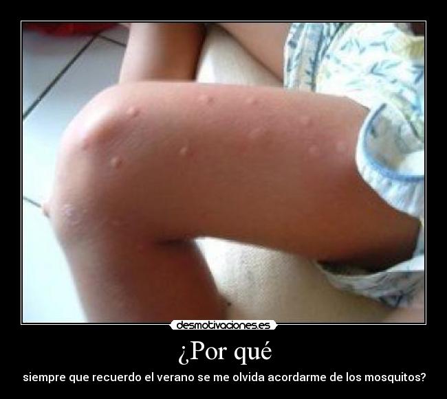 ¿Por qué - siempre que recuerdo el verano se me olvida acordarme de los mosquitos?