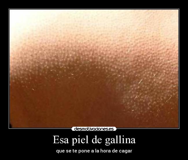 Esa piel de gallina - 