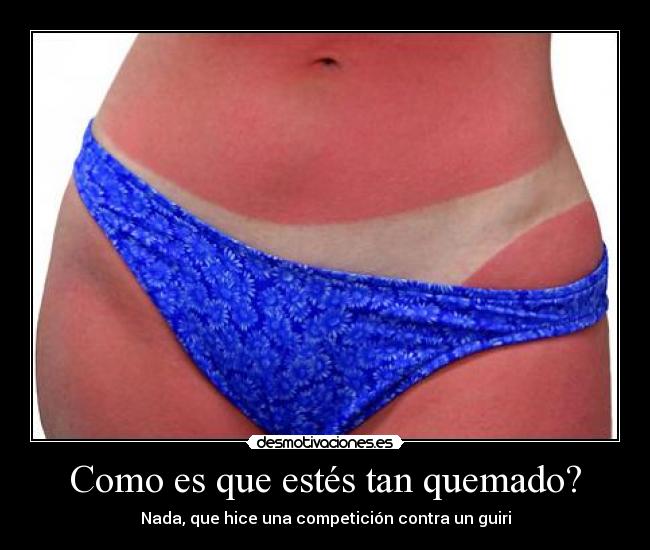 Como es que estés tan quemado? - Nada, que hice una competición contra un guiri