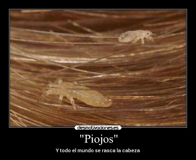 Piojos - 