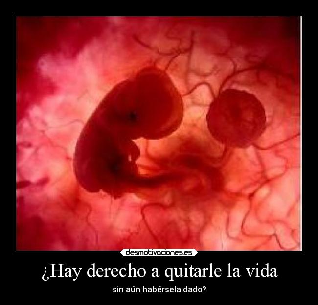 ¿Hay derecho a quitarle la vida -