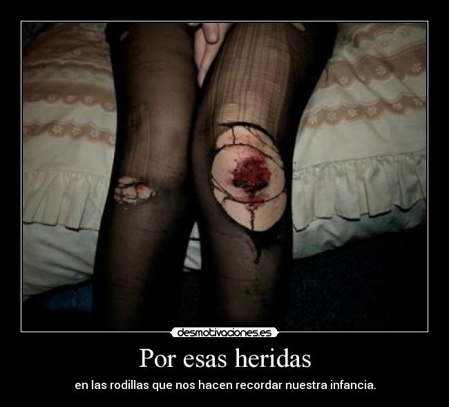 Por esas heridas - en las rodillas que nos hacen recordar nuestra infancia.