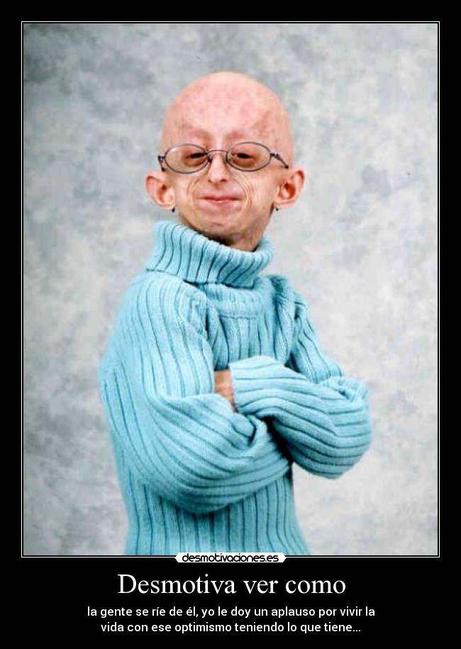 Desmotiva ver como -
