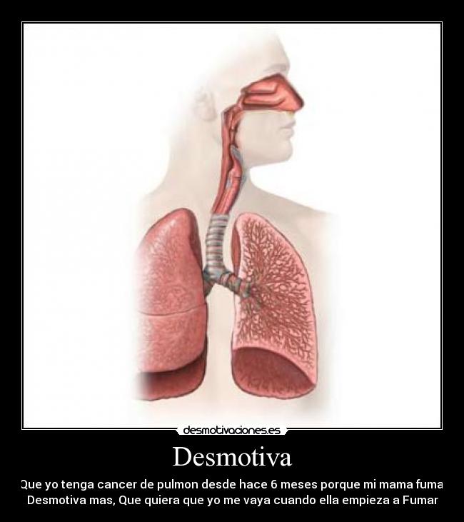 Desmotiva - Que yo tenga cancer de pulmon desde hace 6 meses porque mi mama fuma,
Desmotiva mas, Que quiera que yo me vaya cuando ella empieza a Fumar