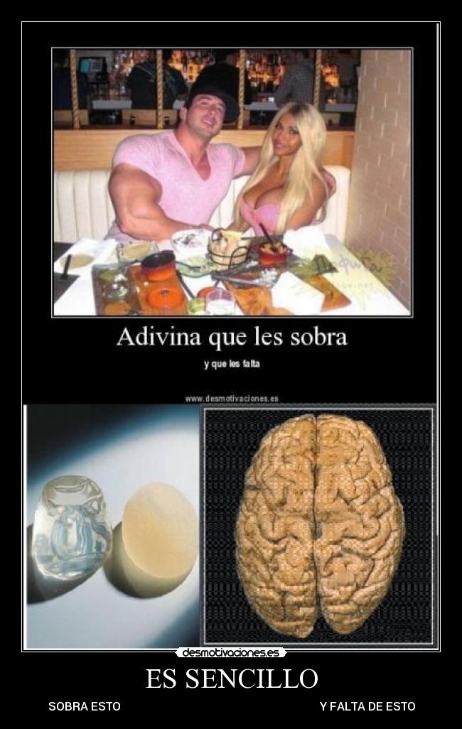 ES SENCILLO - SOBRA ESTO Y FALTA DE ESTO