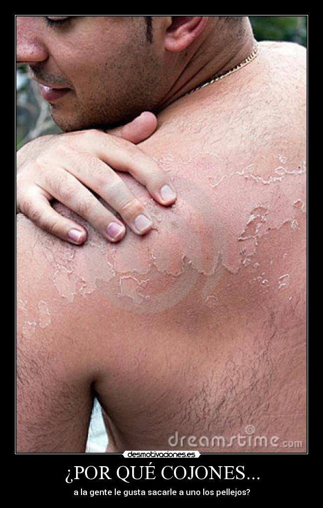 ¿POR QUÉ COJONES... - a la gente le gusta sacarle a uno los pellejos?