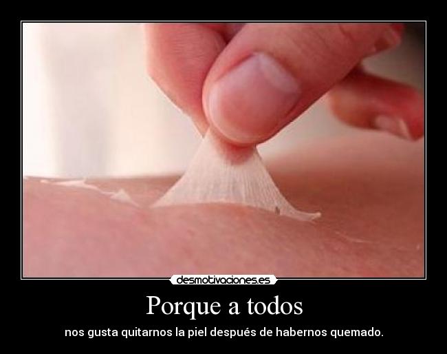Porque a todos - nos gusta quitarnos la piel después de habernos quemado.