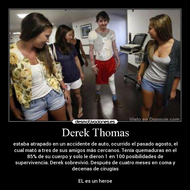 Derek Thomas - estaba atrapado en un accidente de auto, ocurrido el pasado agosto, el
cual mató a tres de sus amigos más cercanos. Tenía quemaduras en el
85% de su cuerpo y solo le dieron 1 en 100 posibilidades de
supervivencia. Derek sobrevivió. Después de cuatro meses en coma y
decenas de cirugías

EL es un heroe