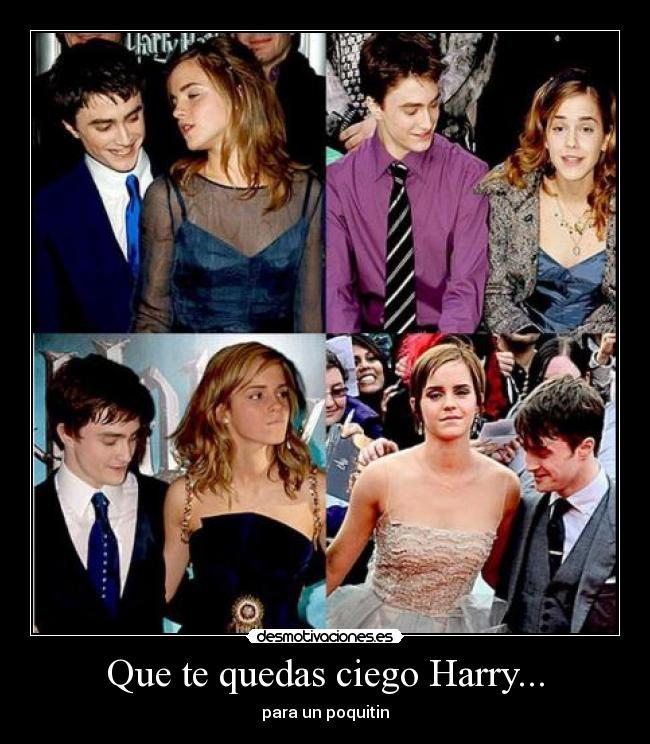 Que te quedas ciego Harry... - 