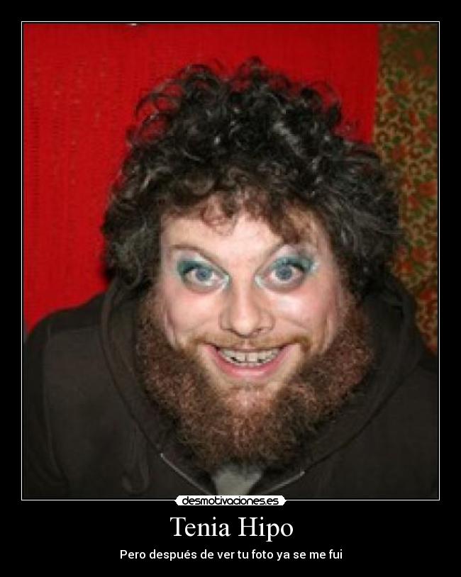 Tenia Hipo - Pero después de ver tu foto ya se me fui